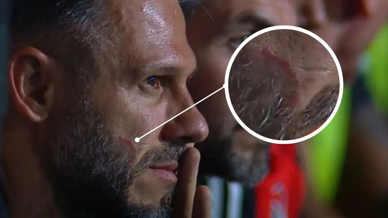 Marca en la cara Martín Demichelis DT River (Foto: Transmisión ESPN Premium)